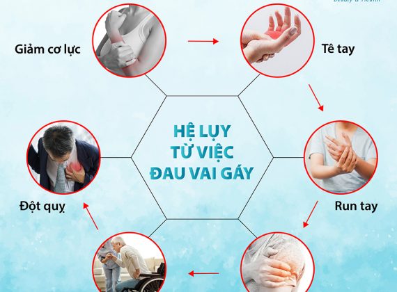 hệ lụy vai gáy web