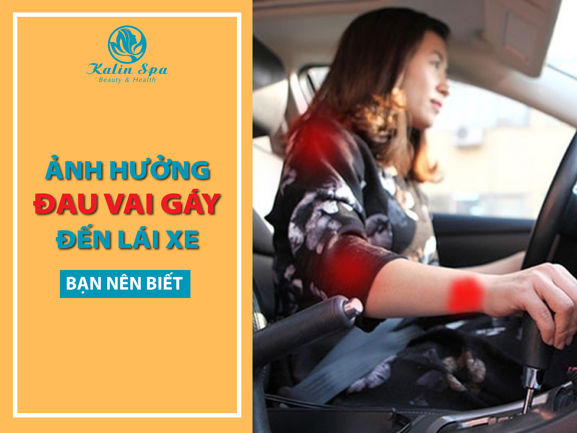 ẢNH HƯỞNG CỦA ĐAU VAI GÁY ĐẾN VIỆC LÁI XE