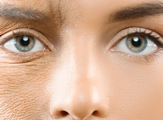 hieu_ve_cac_dau_hieu_lao_hoa_da_de_song_vui_khoe_moi_ngay_2_7d7aa70241